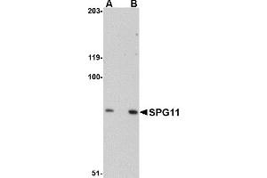 Western Blotting (WB) image for anti-Spastic Paraplegia 11 (Autosomal Recessive) (SPG11) antibody (ABIN1031796)