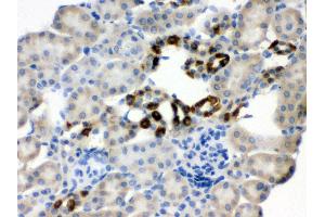 Anti- PGRMC1 Picoband antibody, IHC(P) IHC(P): Mouse Kidney Tissue