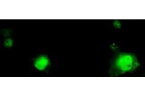 Image no. 1 for anti-Replication Protein A2, 32kDa (RPA2) antibody (ABIN1500739) (RPA2 Antikörper)