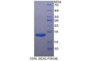 SDS-PAGE analysis of Human KLRB1 Protein. (CD161 Protein)