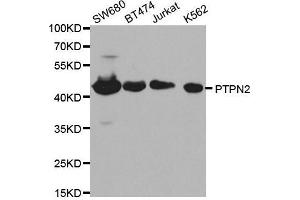 Western blot analysis of extracts of various cell lines, using PTPN2 antibody. (PTPN2 Antikörper  (AA 1-353))