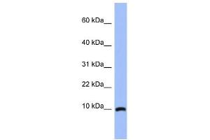 ACBD7 antibody used at 1 ug/ml to detect target protein.