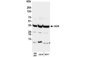 Western Blotting (WB) image for anti-Adenosine Kinase (ADK) (AA 312-362) antibody (ABIN7449946)