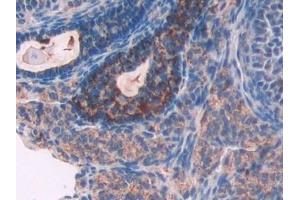 Immunohistochemistry (IHC) image for anti-Tripeptidyl Peptidase I (TPP1) (AA 198-562) antibody (ABIN7440935)