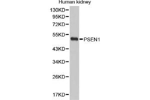 Western blot analysis of extracts of human kidney, using PSEN1 antibody (ABIN5971213). (Presenilin 1 Antikörper)