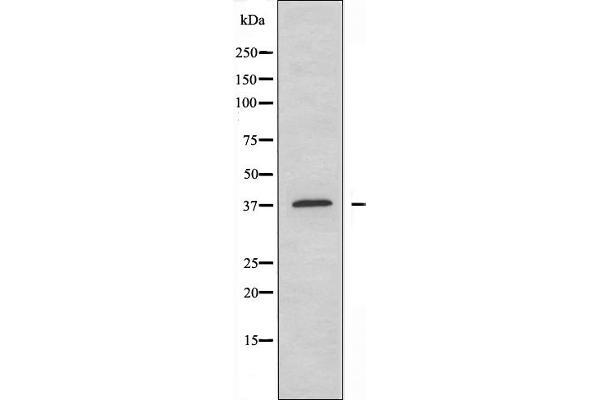 YBX2 Antikörper  (C-Term)