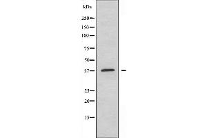 Western blot analysis of extracts from COLO205 cells, using YBOX2 antibody. (YBX2 Antikörper  (C-Term))
