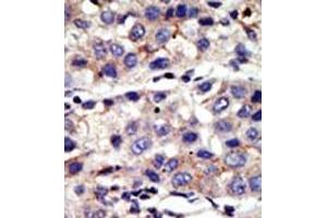 Image no. 2 for anti-Chromobox Homolog 4 (CBX4) (N-Term) antibody (ABIN357750) (CBX4 Antikörper  (N-Term))