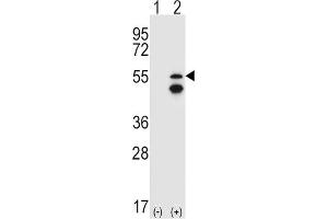 Western Blotting (WB) image for anti-Fyn-Related Kinase (FRK) antibody (ABIN3003444) (FRK Antikörper)
