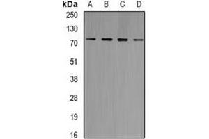 Western blot analysis of GlyRS expression in Jurkat (A), Raji (B), HT29 (C), mouse brain (D) whole cell lysates. (GlyRS Antikörper)