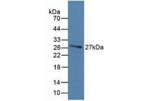 Figure. (Vitamin D-Binding Protein Antikörper  (AA 209-401))