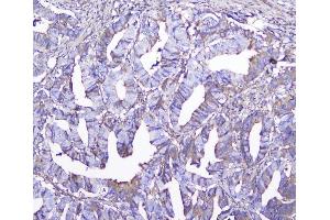 IHC analysis of GSTM1 using anti-GSTM1 antibody (ABIN5693233).