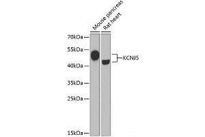 Western blot analysis of extracts of various cell lines using KCNJ5 Polyclonal Antibody at dilution of 1:1000. (KCNJ5 Antikörper)
