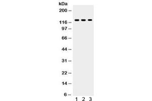 Western blot testing of 1) MCF7, 2) COLO320 and 3) Jurkat lysate with TLR7 antibody.