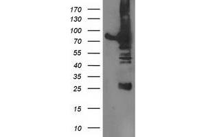 Western Blotting (WB) image for anti-Dipeptidyl-Peptidase 3 (DPP3) antibody (ABIN1497829) (DPP3 Antikörper)