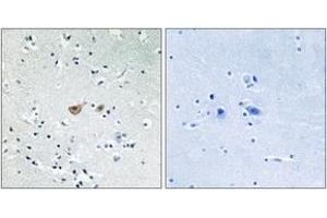 Immunohistochemistry analysis of paraffin-embedded human brain tissue, using FKHR (Ab-256) Antibody. (FOXO1 Antikörper  (AA 223-272))