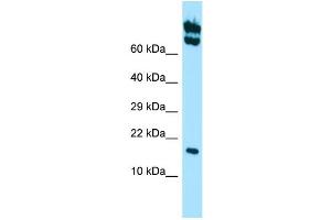WB Suggested Anti-HSPB11 Antibody Titration: 1.