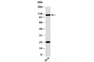 Western blot testing of mouse samples with TLR9 antibody at 2ug/ml.