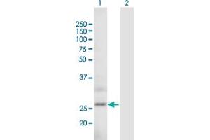 Western Blotting (WB) image for anti-Actin Related Protein 2/3 Complex, Subunit 5-Like (ARPC5L) (AA 1-153) antibody (ABIN529414)
