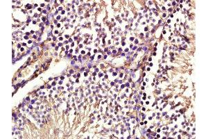 Paraformaldehyde-fixed, paraffin embedded mouse testis tissue, Antigen retrieval by boiling in sodium citrate buffer(pH6) for 15min, Block endogenous peroxidase by 3% hydrogen peroxide for 30 minutes, Blocking buffer (normal goat serum) at 37°C for 20min, Antibody incubation with Rabbit Anti-Aph-1b Polyclonal Antibody, Unconjugated  at 1:400 overnight at 4°C, followed by a conjugated secondary and DAB staining (APH1B Antikörper  (AA 51-150))