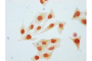 Immunocytochemistry analysis of ABIN7127684 diluted at 1:80 and staining in Hela cells(treated with Pervanadate) performed on a Leica BondTM system. (Rekombinanter CDK2 Antikörper  (pTyr15))