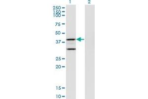Western Blot analysis of PTGES2 expression in transfected 293T cell line by PTGES2 monoclonal antibody (M01), clone 5B7. (PTGES2 Antikörper  (AA 270-377))