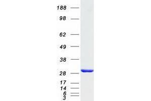 Western Blotting (WB) image for Ubiquitin-Conjugating Enzyme E2T (Ube2t) protein (Myc-DYKDDDDK Tag) (ABIN2734873)