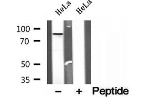 Western blot analysis of extracts of HeLa cells, using OSBP antibody. (OSBP Antikörper  (Internal Region))