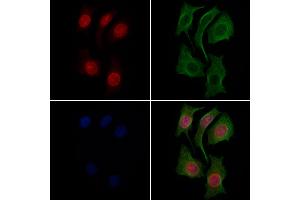ABIN6265173 and ABIN6269300 staining Hela cells by IF/ICC.
