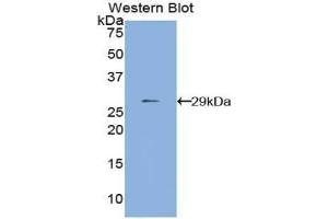 Detection of Recombinant MMP24, Human using Polyclonal Antibody to Matrix Metalloproteinase 24 (MMP24) (MMP24 Antikörper  (AA 429-642))