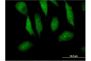 Immunofluorescence of monoclonal antibody to MTPN on HeLa cell.