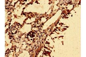 Immunohistochemistry of paraffin-embedded human lung tissue using ABIN7176714 at dilution of 1:100 (SLC39A8 Antikörper  (AA 30-132))