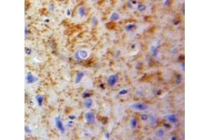 IHC-P analysis of Brain tissue, with DAB staining. (LCP2 Antikörper  (AA 202-463))