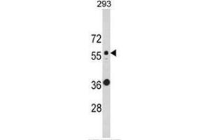 Western blot analysis of KRT10 Antibody (N-term) in 293 cell line lysates (35ug/lane). (Keratin 10 Antikörper  (N-Term))