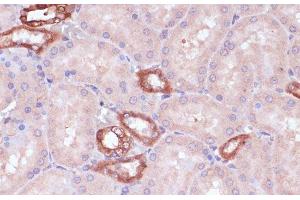 Immunohistochemistry of paraffin-embedded Rat kidney using UGT2B15 Polyclonal Antibody at dilution of 1:100 (40x lens). (UGT2B15 Antikörper)