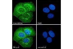 ABIN343052 Immunofluorescence analysis of paraformaldehyde fixed MCF7 cells, permeabilized with 0. (ABCA4 Antikörper  (AA 2250-2263))