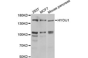 Western blot analysis of extracts of various cell lines, using HYOU1 antibody (ABIN2563312) at 1:1000 dilution. (HYOU1 Antikörper)