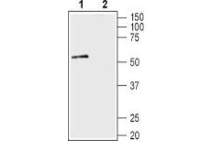 Western Blotting (WB) image for anti-Syntrophin, alpha 1 (Dystrophin-Associated Protein A1, 59kDa, Acidic Component) (SNTA1) (AA 191-205), (Intracellular) antibody (ABIN7043797)