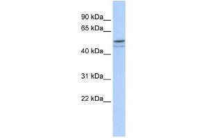 WB Suggested Anti-DMRTA1 Antibody Titration: 0. (DMRTA1 Antikörper  (Middle Region))