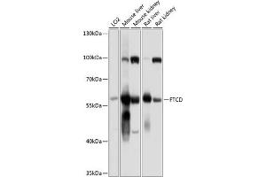Western blot analysis of extracts of various cell lines, using FTCD antibody (ABIN6133518, ABIN6140789, ABIN6140790 and ABIN6225015) at 1:1000 dilution. (FTCD Antikörper  (AA 412-541))