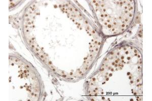 Immunoperoxidase of monoclonal antibody to NOL4 on formalin-fixed paraffin-embedded human testis. (NOL4 Antikörper  (AA 425-524))