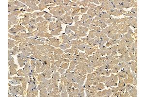 ABIN7094532 and ABIN7098581 at 1/100 staining rat heart tissue by IHC-P.