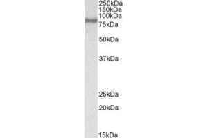 Image no. 1 for anti-Acyl-CoA Synthetase Long-Chain Family Member 4 (ACSL4) (C-Term) antibody (ABIN487992) (ACSL4 Antikörper  (C-Term))