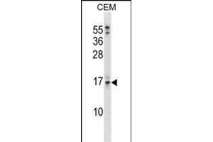 SOSTDC1 Antibody (C-term) (ABIN1536776 and ABIN2849017) western blot analysis in CEM cell line lysates (35 μg/lane). (SOSTDC1 Antikörper  (C-Term))