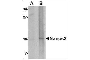 Western blot analysis of Nanos2 in rat brain tissue lysate with this product at (A) 1 and (B) 2 μg/ml. (NANOS2 Antikörper  (N-Term))