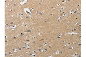 The image on the left is immunohistochemistry of paraffin-embedded Human brain tissue using ABIN7191891(PIP5K1C Antibody) at dilution 1/25, on the right is treated with synthetic peptide. (PIP5K1C Antikörper)