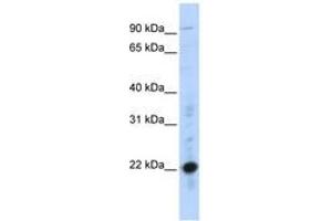 Image no. 1 for anti-Cysteine-Rich Protein 2 (CRIP2) (C-Term) antibody (ABIN6740380) (CRIP2 Antikörper  (C-Term))