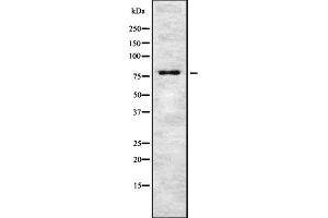 Western blot analysis of TSYL2 expression in HEK293 cells ,The lane on the left is treated with the antigen-specific peptide. (TSPY-Like 2 Antikörper  (Internal Region))
