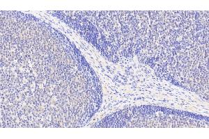 Detection of ACAT1 in Human Lymph node Tissue using Polyclonal Antibody to Acetyl Coenzyme A Acetyltransferase 1 (ACAT1)