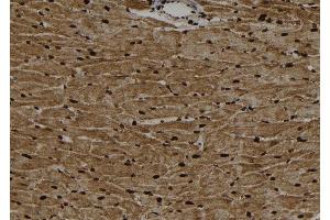 ABIN6267100 at 1/100 staining Rat heart tissue by IHC-P.